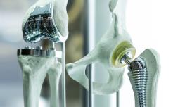 Knee joint
